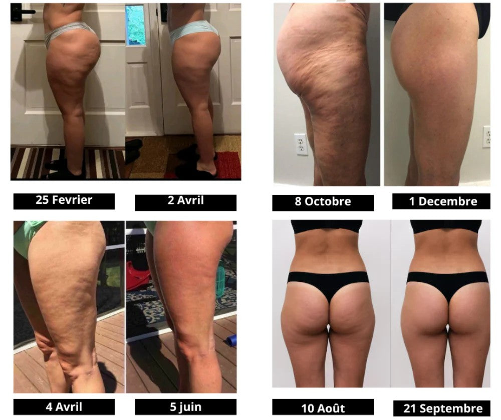 Celluligo™ | Leggings compressif 3D anti cellulite