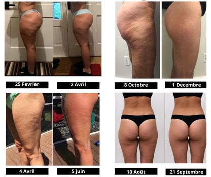 Celluligo™ | Leggings compressif 3D anti cellulite